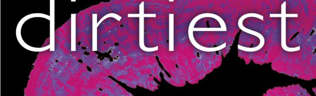Protetto: DIRTIEST SECRET